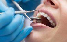 اصطلاحات/عبارات و واژگان مربوط به دندانپزشکی در زبان انگلیسی