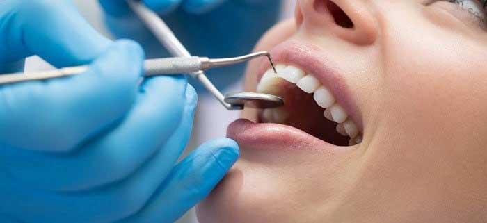 اصطلاحات/عبارات و واژگان مربوط به دندانپزشکی در زبان انگلیسی