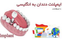 ایمپلنت دندان به انگلیسی (اصلاحات پرکاربرد )